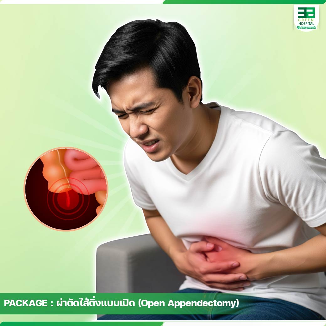 ผ่าตัดไส้ติ่ง (แบบเปิด) - โรงพยาบาลลาดพร้าว - Ladprao General Hospital